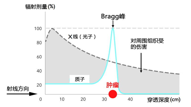 尖端放療技術——質子治療