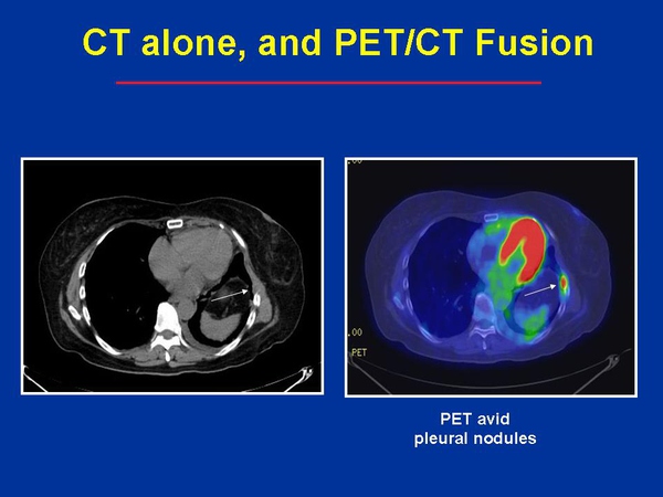 Pet Scan for Early Cancer Detection in Pets: A Comprehensive Guide