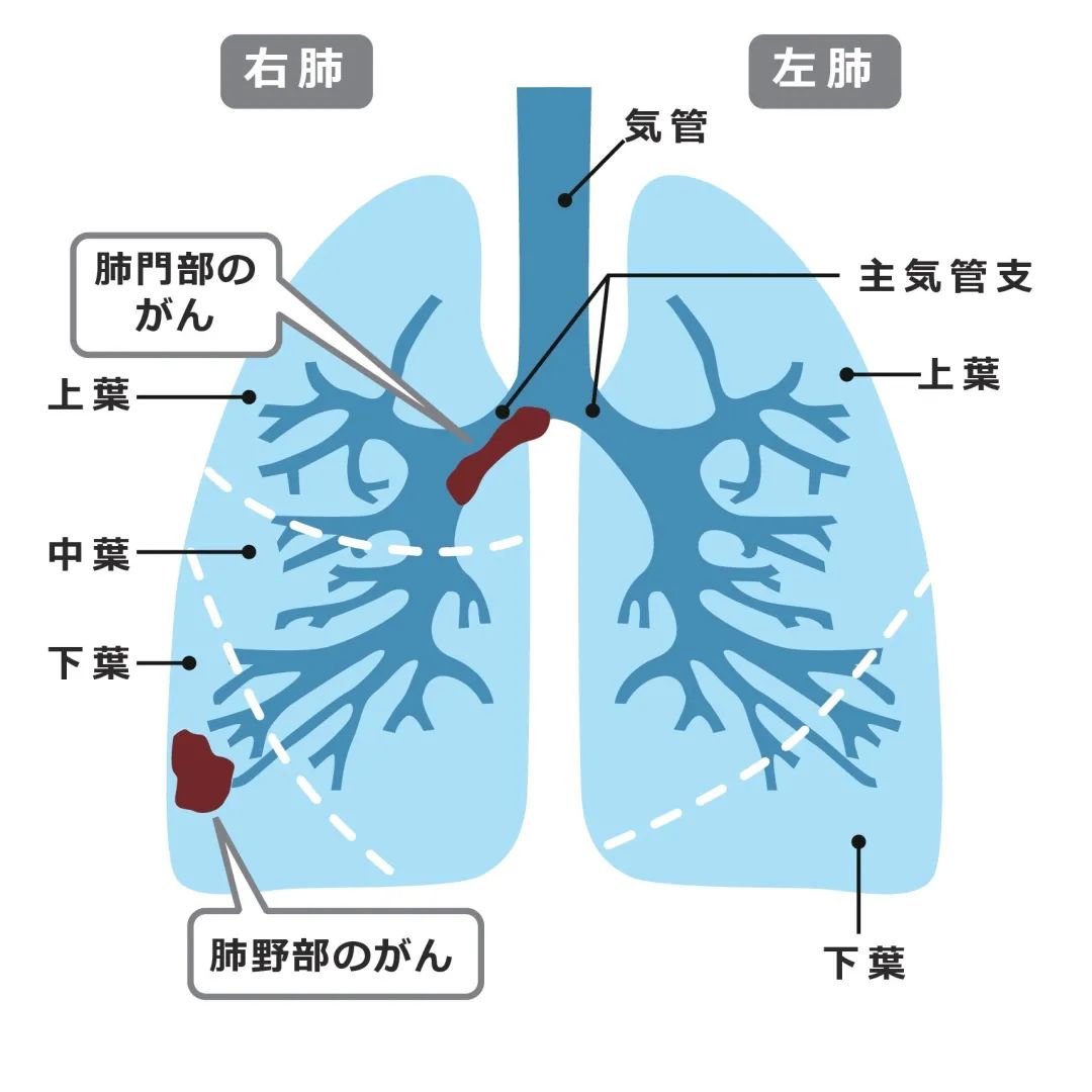 肺上界的位置图片图片