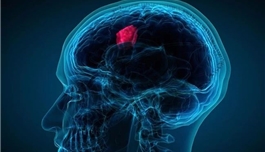 注意！这7大症状可能是脑瘤的早期征兆
