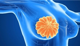 Tukysa获批！HER2阳性乳腺癌再添新药