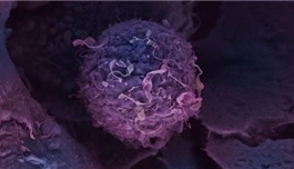 降低25%复发，极大可能治愈：HR+高危乳腺癌取得突破性研究进展